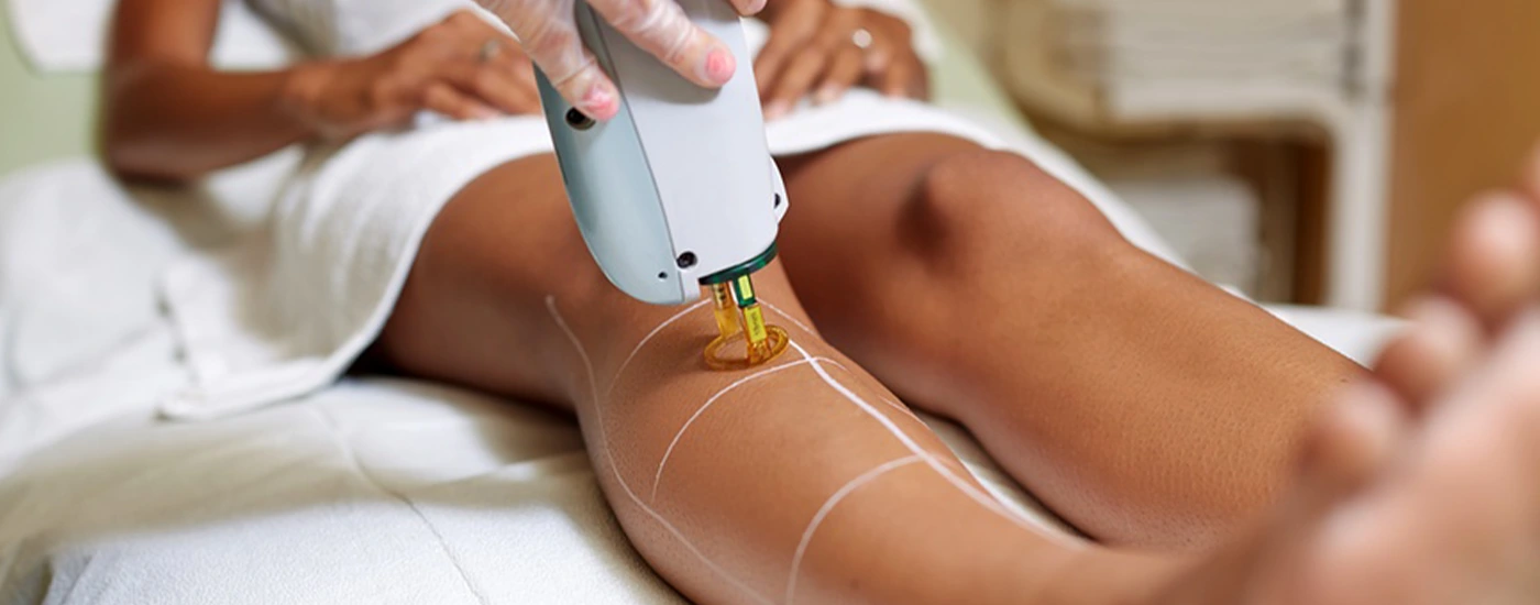 Permanent Hair Removal • The Source MediSpa